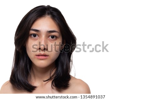 Beautiful asian woman gets freckles, blemish, pimple or acne and dull skin on her face. Charming beautiful young woman get problems of her skin. She looks unhappy. isolated on white, copy space Сток-фото © 