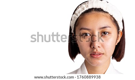 Beautiful asian woman gets freckles, and dull skin on her face. Pretty young woman get problems of facial skin. She looks unhappy. isolated on white, copy space. Asia lady get bare face no makeup  