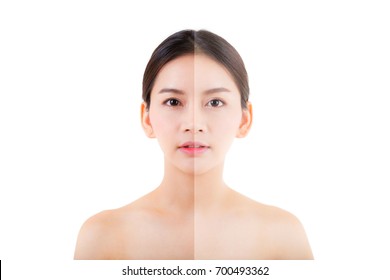 Beautiful Asian Young Woman On A White Background, Beauty Cosmetic Concept. Retouch Before And After.face Divided In Two Parts, Poor Condition The Skin In Good Condition