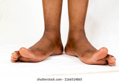 Black Nude Feet