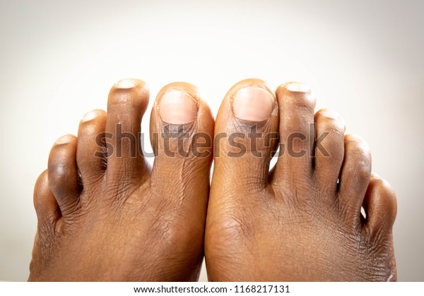 Pretty Black Girl Feet