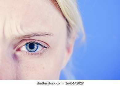 Beautiful Blonde Woman With Clean Skin And Frekles Frown Her Brows Over Bright Blue Background. Thin Brows And Blue Eyes. Thundery Brow And Sad Look