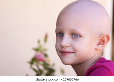 Beautiful Child With Cancer And Hair Loss Due To Chemotherapy