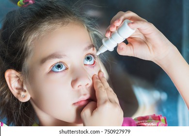 Beautiful Child Dripping In Eye Drops Conjunctivitis.