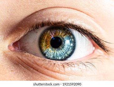 beautiful close up photo of eye that is brown on the one side and blue on the other side. Segmental heterochromia (heterochromia iridium), different parts of one iris are different colors