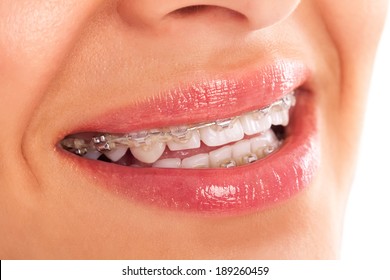 Beautiful denture close up isolated - Shutterstock ID 189260459