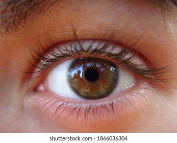 chimera human eyes