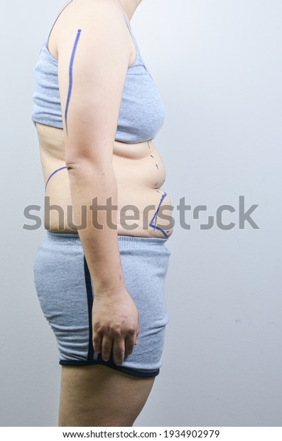 Beautiful, fat, beautiful, wear
gray, suitable for medical purposes for those who want to lose
weight.