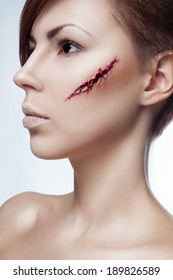 Beautiful Girl With A Cut On Face