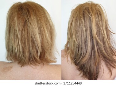 Beautiful Hair Woman Before And After Growth