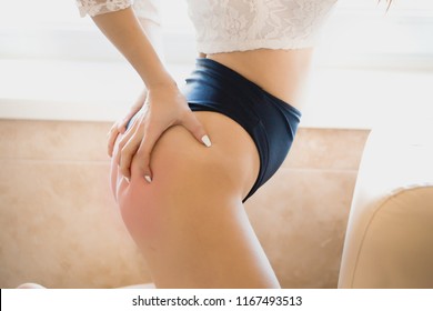 Beautiful horny nude girl buttocks , naked body ass with red spank hands . Erotic couple Spanked Images, Stock Photos & Vectors | Shutterstock