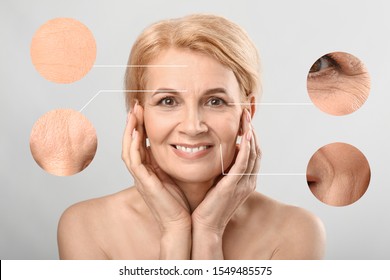 Beautiful Mature Woman With Skin Problem On Light Background. Process Of Aging