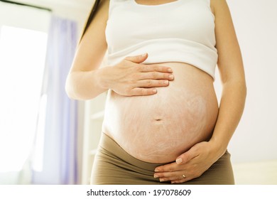 beautiful pregnant woman applying anti stretch mark cream or moisturizer