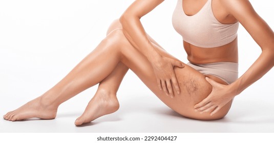 Beautiful slender woman sits on a couch in a spa salon. She shows varicose veins in the lower legs.Treatment of varicose veins and capillaries.