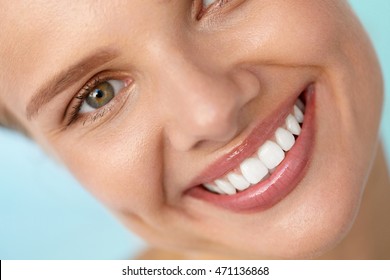 Beautiful Smile. Closeup Of Beautiful Happy Smiling Woman With White Teeth And Fresh Face. Beauty Girl With Cosmetic Lip Balm On Her Full Lips. Dental Health, Lip Care Concept. High Resolution Image