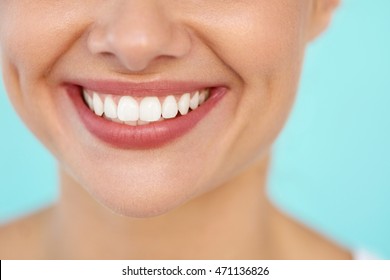 Beautiful Smile With White Teeth. Closeup Of Smiling Woman Mouth With Natural Plump Full Lips And Healthy Perfect Smile. Teeth Whitening, Dental Health And Lip Care Concepts. High Resolution Image 