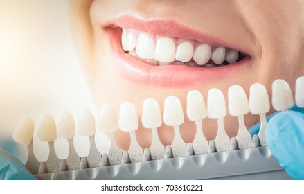 Beautiful smile and white teeth of a young woman. Matching the shades of the implants or the process of teeth whitening.