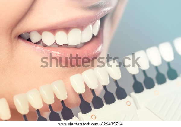 Beautiful\
smile and white teeth of a young woman. Matching the shades of the\
implants or the process of teeth\
whitening.