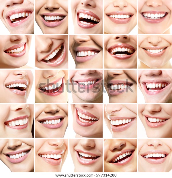 Bellissimi Sorrisi Perfetti Sorrisi Larghi Con Foto Stock Modifica Ora