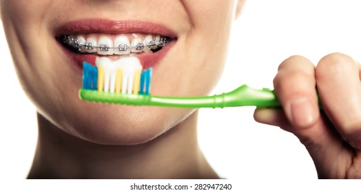 Beautiful smiling girl with retainer for teeth brushing teeth on a white background.