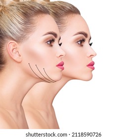 Beautiful woman before and after fat chin correction. - Shutterstock ID 2118590726
