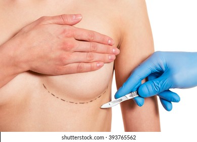 Beautiful woman covering her breast with sketches, surgeon in medical gloves is holding a scalpel, isolated on a white background, cropped