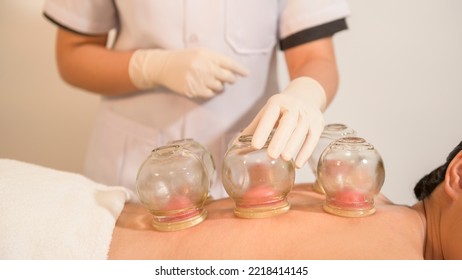 
Beautiful Woman Received cupping treatment on back by  therapist, chinese medicine treatment, health and healing concept. - Powered by Shutterstock