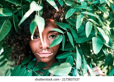 Beautiful woman with vitiligo and curly hair amongst leafs - Body positivity, organic beauty and skin care concept. - Powered by Shutterstock