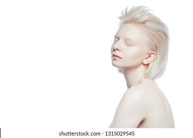 albino 3 copy