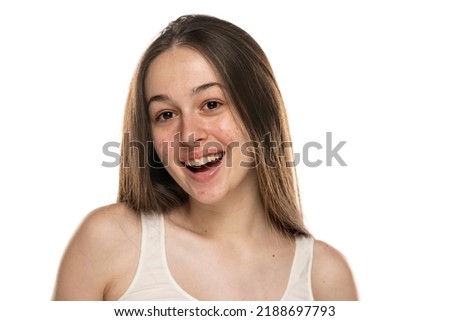 beautiful young smiling women with problemati skin, on white background