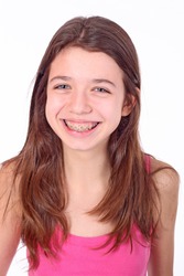 Beautiful young teen girl with brackets on teeth in white, a young girl ...