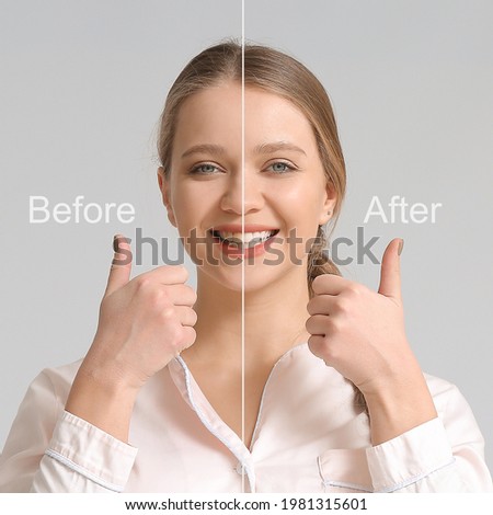 Beautiful young woman before and after smile makeover procedure on grey background