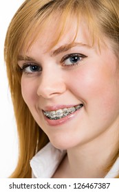 Beautiful Young Woman With Brackets On Teeth Close Up