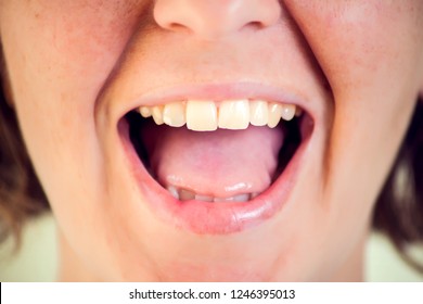 Beautiful young woman with healthy teeth on white background. Close up shot. Healthcare concept