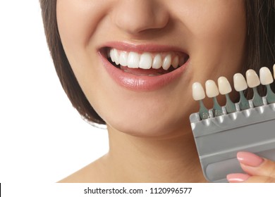 Teeth Whitening Colour Chart