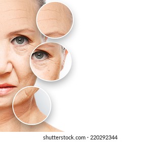 Beauty Concept Skin Aging. Anti-aging Procedures, Rejuvenation, Lifting, Tightening Of Facial Skin, Restoration Of Youthful Skin Anti-wrinkle