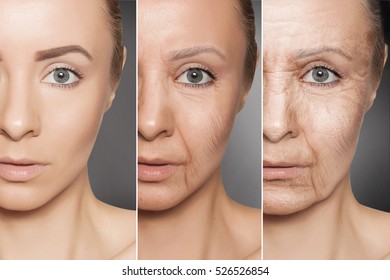 Beauty Concept Skin Aging, Anti-aging Procedures On Caucasian Woman Face