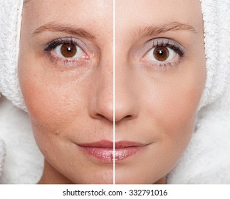 Beauty Concept - Skin Care, Anti-aging Procedures, Rejuvenation, Lifting, Tightening Of Facial Skin