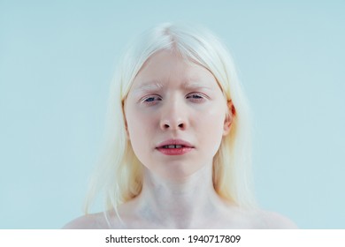 Heterochromia iridum Images, Stock Photos & Vectors | Shutterstock