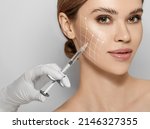 Beauty injections. Lifting lines on a woman