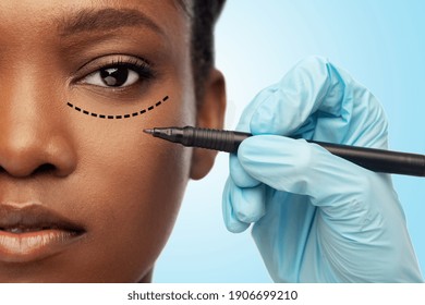 beauty, plastic surgery and people concept - close up of face of beautiful young african american woman with surgical mark under her eye and hand in glove with marker over blue background - Powered by Shutterstock