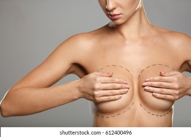 Beauty Treatment. Slim Topless Young Woman With Hot Body Holding Tight Sexy Breast With Hands. Beautiful Woman Covering Breast With Black Surgical Lines. Plastic Surgery Concept. High Resolution