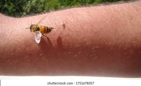 Bee : Apis Mellifera.
Treatment By Honey Bee Sting.
Closeup Honey Bee Stinging A Hand.
Close Up Bee Worker.
Insects, Insect, Animal, Wildlife, Wild Nature, Forest, Woods, Garden
Beauty Of Pollination