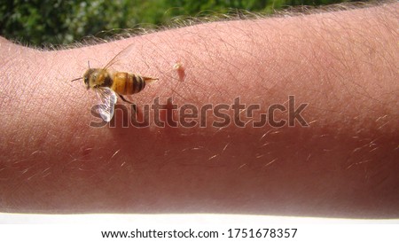 bee : apis mellifera.
treatment by honey bee sting.
closeup honey bee stinging a hand.
close up bee worker.
insects, insect, animal, wildlife, wild nature, forest, woods, garden
beauty of pollination