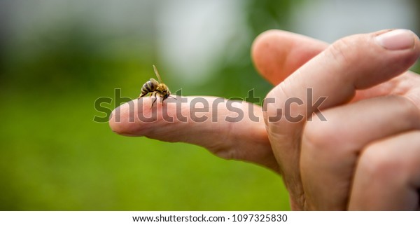 the bee stings the\
person in the finger