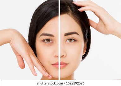 Brow Lift Hd Stock Images Shutterstock