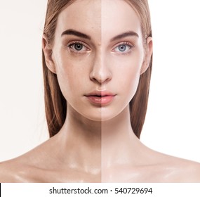 Before After Close Up Beauty Skin Shot