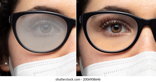 Before And After Comparison Of Fogged Glasses For Mask Use. Closeup Of A Girl's Eye With Steam On The Lenses And Face Mask.