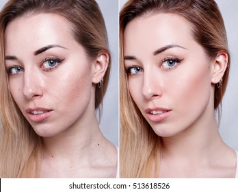 12,954 Makeup pimple Images, Stock Photos & Vectors | Shutterstock