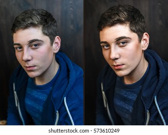 Before And After Photoshop Young Guy With Pimples . Retouch Skin Naturally